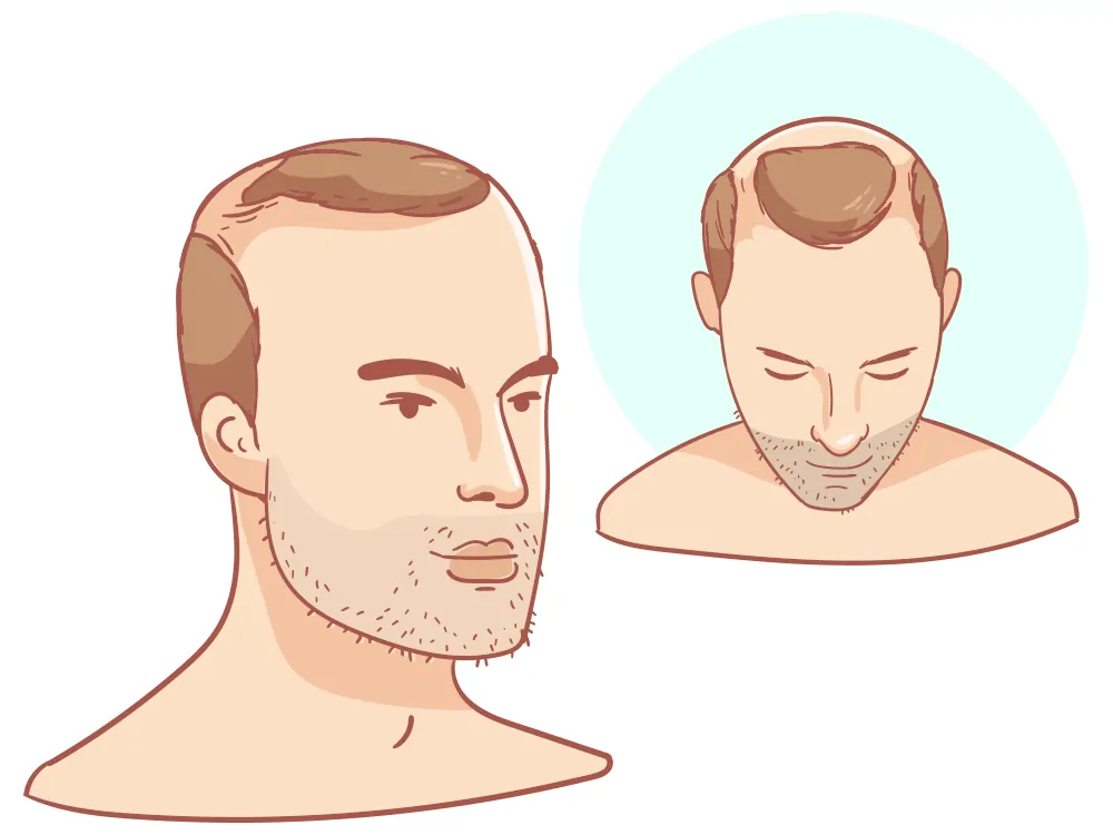 Semi curând